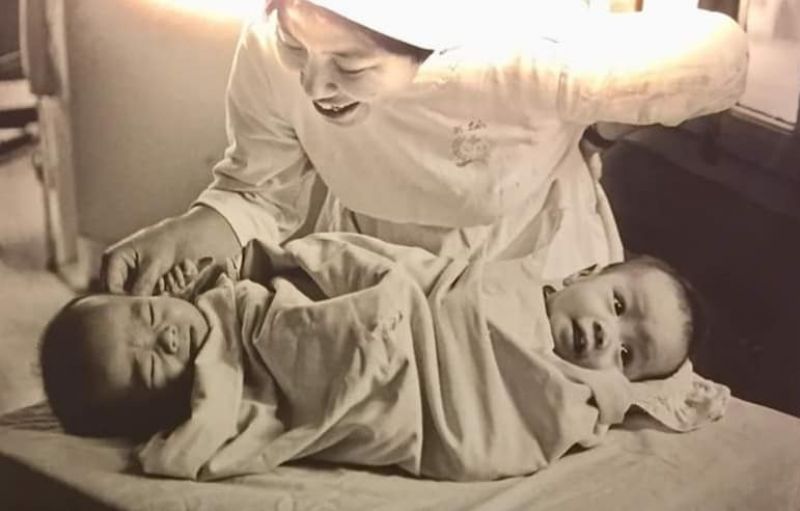 cặp song sinh việt đức 2 cặp song sinh việt đức 2